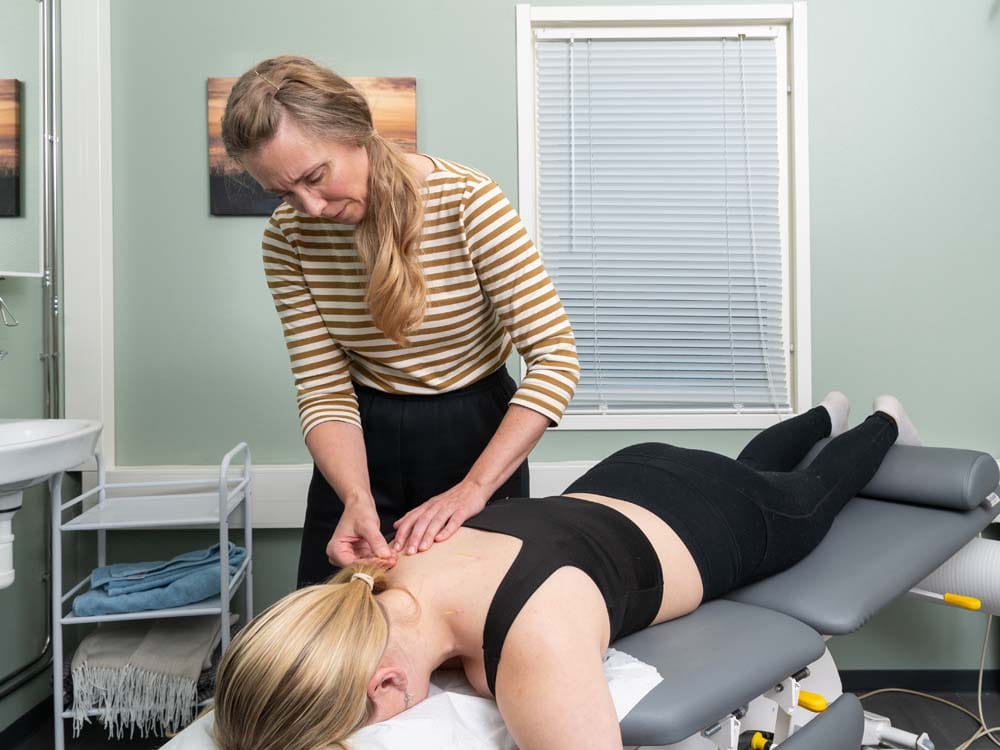 Akupunktio Jyväsykylä